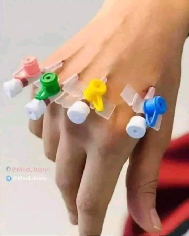 DocteurNtouba's tweet image. 6- La couleur rouge (#14) est utilisée pour le cathéter veineux central et nécessite de grosses veines, et il est préférable de frapper l'arrière de la paume. Utilisations: salle d'opération, urgences,  transfusions. 

6/
@DocteurNtouba #InfluenceForHealth #FOLLOW #RT #FAV #DM