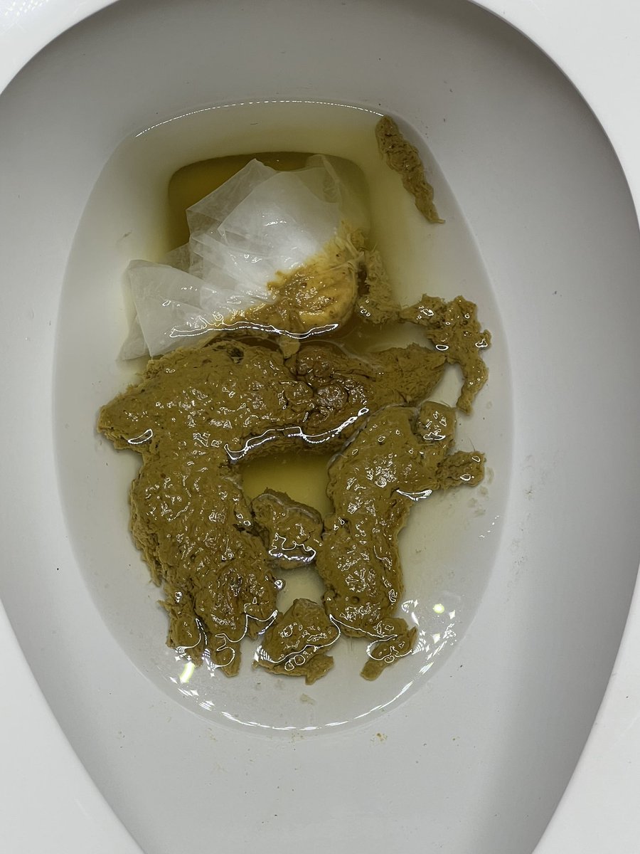 SuspiciousEx's tweet photo. 30min in counting, one of my followers is coming over, getting on his hands &amp; knees as he eat my shit out the 🚽 🐷💩… I can’t wait to watch this pig eat,  then lick my shitty hole 🍩 clean. #scatplay #toiletperv #gaysex #nastypig #scateater #shit #cumdumpfaggot #addictedtoscat https://t.co/pPJ6Jp83wX