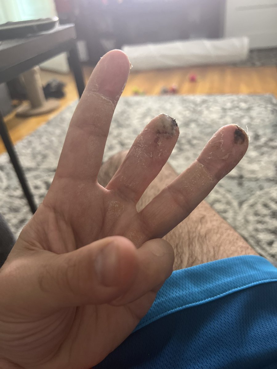 anthocas0383's tweet photo. @Gladd I could use the help Gladd had a accident a month and a half ago at work and money has been tight on workman’s comp. #4and2/3 https://t.co/abjCXsJo0Z