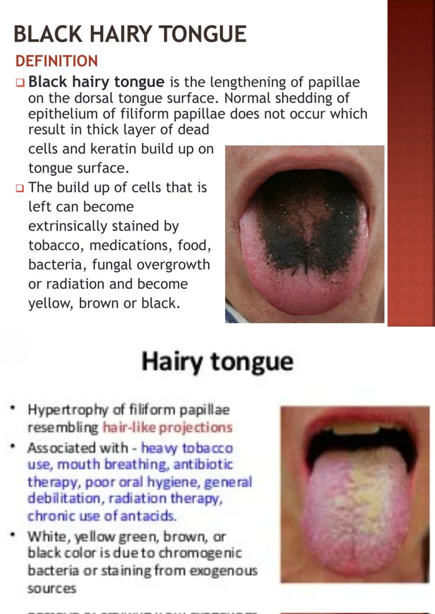 Thick black hairs coated a mans tongue Heres why  Live Science