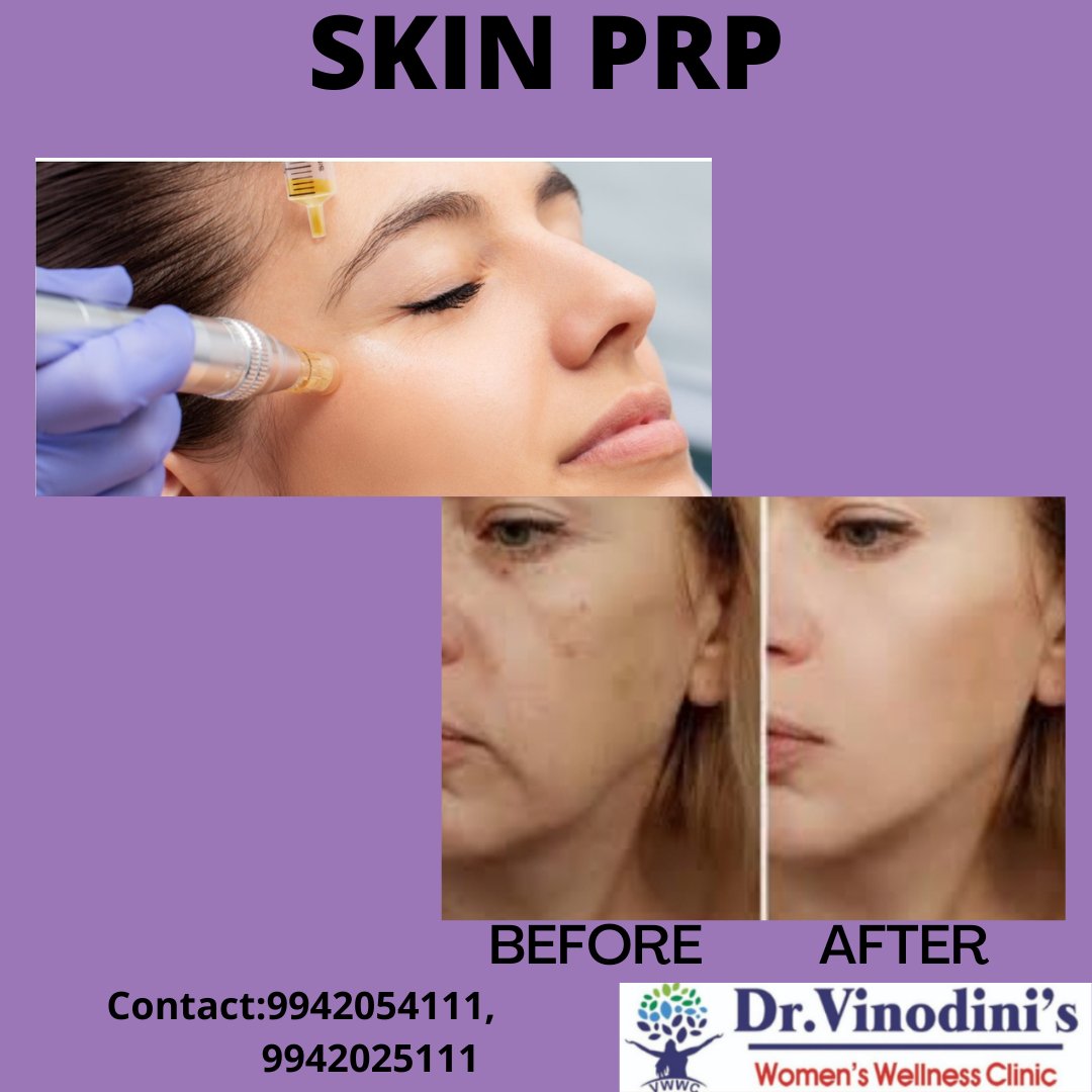 DrSolution's tweet photo. #drvinodinithanjavur #drvinodiniwomenswellnessclinic #drvhs #cosmetology #trichology #skinwhitening #microblading #darklipcorrection #scarremoval #tattoremoval #chemicalpeel #lashlift #wartremoval 
For further details contact us 9942054111,9942025111 https://t.co/oGi9yaO3br