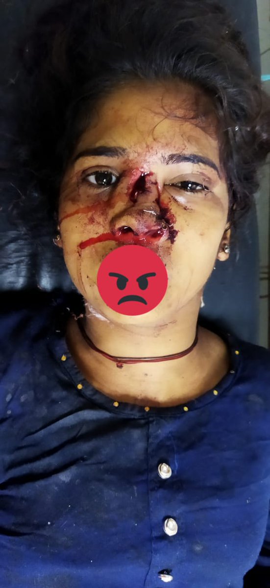 कानपुर देहात के रूरा क्षेत्र में एससी समाज की बेटी के साथ गोलू यादव एवम साथियों ने घर से जबरन उठाने का प्रयास किया
असफल होने पर बदसलूकी की व नाक काट दी जो बहुत ही शर्मनाक है,मुख्यमंत्री जी से आग्रह है कि गोलू यादव के साथ बाकी गुनाहगारों गिरफ्तार करवाया जाए और फांसी की सजा दी जाए।