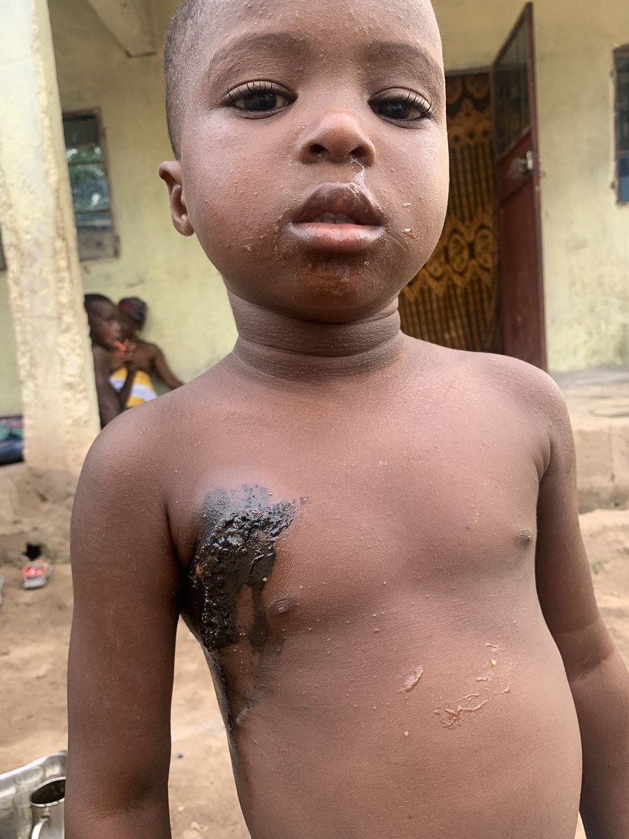 Mariamadramme16's tweet photo. Hello everyone it’s my younger brother he is very sick. We need support please donate us anything you have in your heart we will appreciate it as a God Fath 😭🙏 https://t.co/v9Oht6qlL7