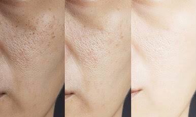 Rekomendasi masker terbaik untuk mengangkat komedo dan mengecilkan pori-pori

~a thread~