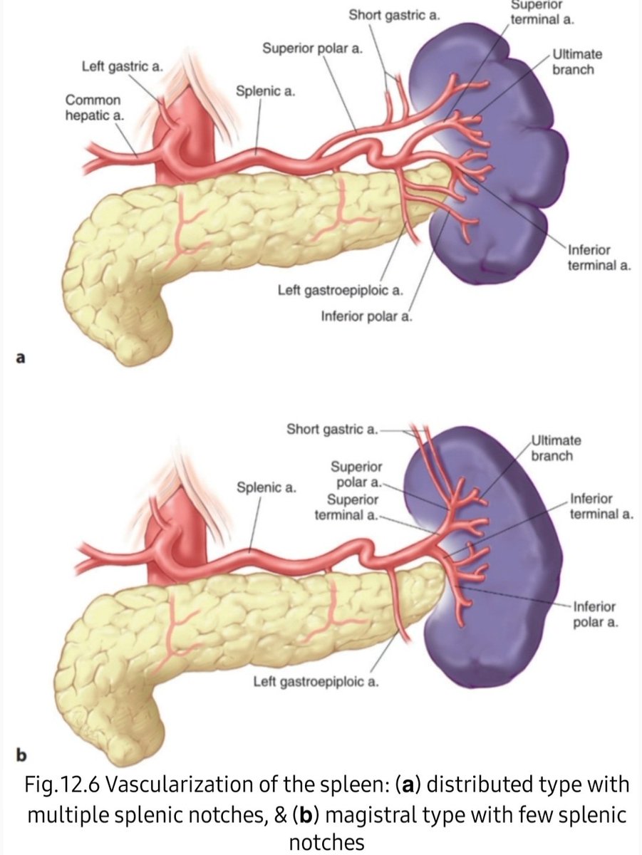 DRAFTABAHMED7's tweet image. Vascular Anatomy of the Spleen:
(𝗮) 𝗗𝗶𝘀𝘁𝗿𝗶𝗯𝘂𝘁𝗲𝗱 type with multiple splenic notches, &amp;amp; (𝗯) 𝗠𝗮𝗴𝗶𝘀𝘁𝗿𝗮𝗹 type with few splenic notche
𝗥𝗲𝗳:Advanced Laparoscopic Surgery, Techniques &amp;amp; Tips,  2nd Edition.
#splenectomy 
#GITwitter