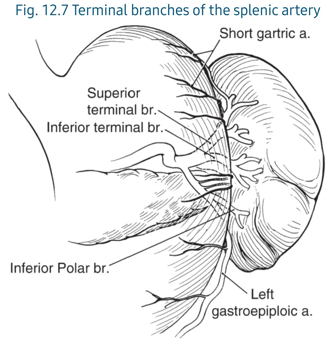 DRAFTABAHMED7's tweet image. Vascular Anatomy of the Spleen:
(𝗮) 𝗗𝗶𝘀𝘁𝗿𝗶𝗯𝘂𝘁𝗲𝗱 type with multiple splenic notches, &amp;amp; (𝗯) 𝗠𝗮𝗴𝗶𝘀𝘁𝗿𝗮𝗹 type with few splenic notche
𝗥𝗲𝗳:Advanced Laparoscopic Surgery, Techniques &amp;amp; Tips,  2nd Edition.
#splenectomy 
#GITwitter