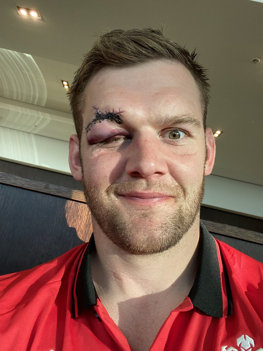 Danny Lydiate tweet media