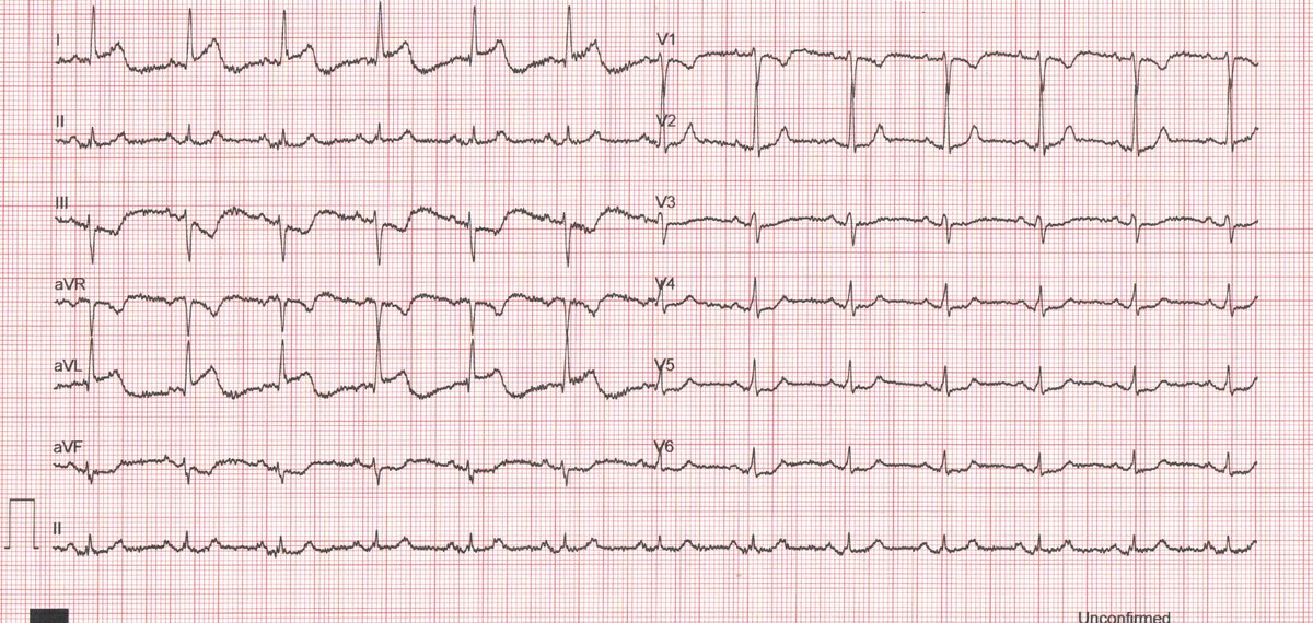 Emre Aslanger tweet media