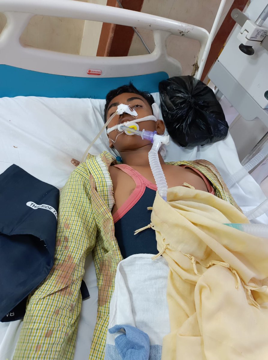 devendr06585270's tweet photo. #principalnspst Salon Rae Bareli A child is battling for his life and death due to the mistake of the principal and administration. He is in ICU for last 48 hours.
#Juctice_for_alok_singh  
#YogiAdityanath 
#PMOIndia 
#DM_Raebareli 
#PMOIndia https://t.co/q57ve8gDjg