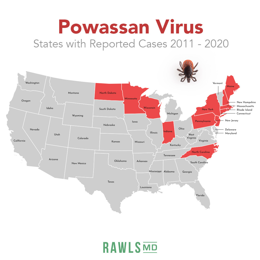 13 states have reported Powassan virus between 2011-2020. They are: MA, MN, WI, NY, NJ, CT, PA, ME, NH, RI, ND, IN, NC. Read more about this emerging threat here:
bit.ly/3Rlh6HG
#powassan #powassanvirus #ticks #tickborneillness #rawlsmd