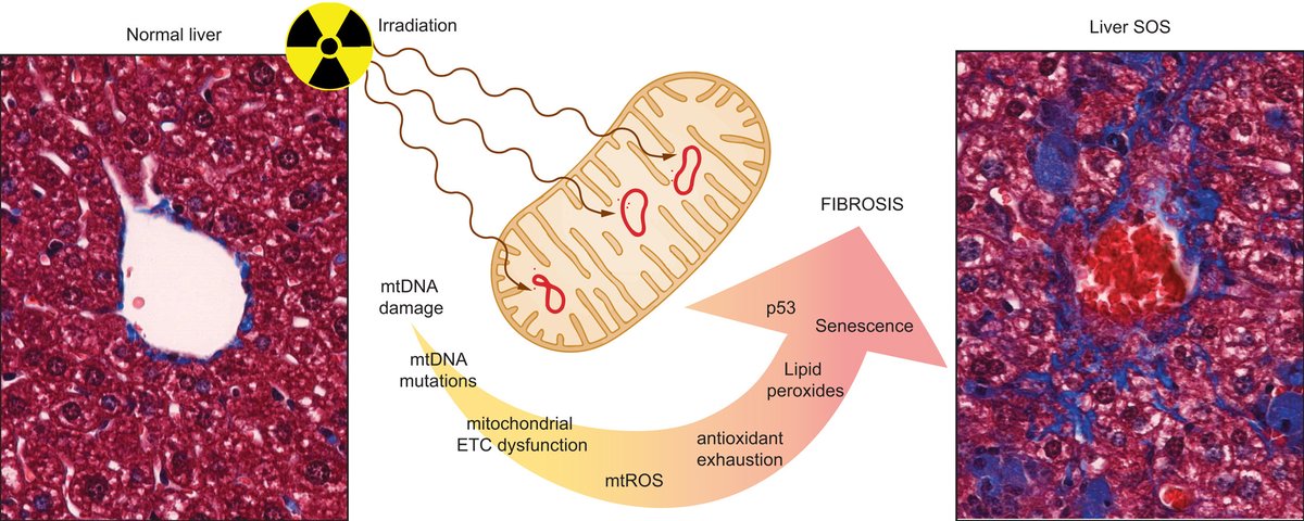 In our July issue❕

A new mouse model of #RadiationInduced #LiverDisease reveals #mitochondrial dysfunction as an underlying #fibrotic stimulus

🔓#OpenAccess at👉bit.ly/3yHRGeG

<a href="/strokeogh/">Deborah Keogh-Stroka</a>
#LiverTwitter