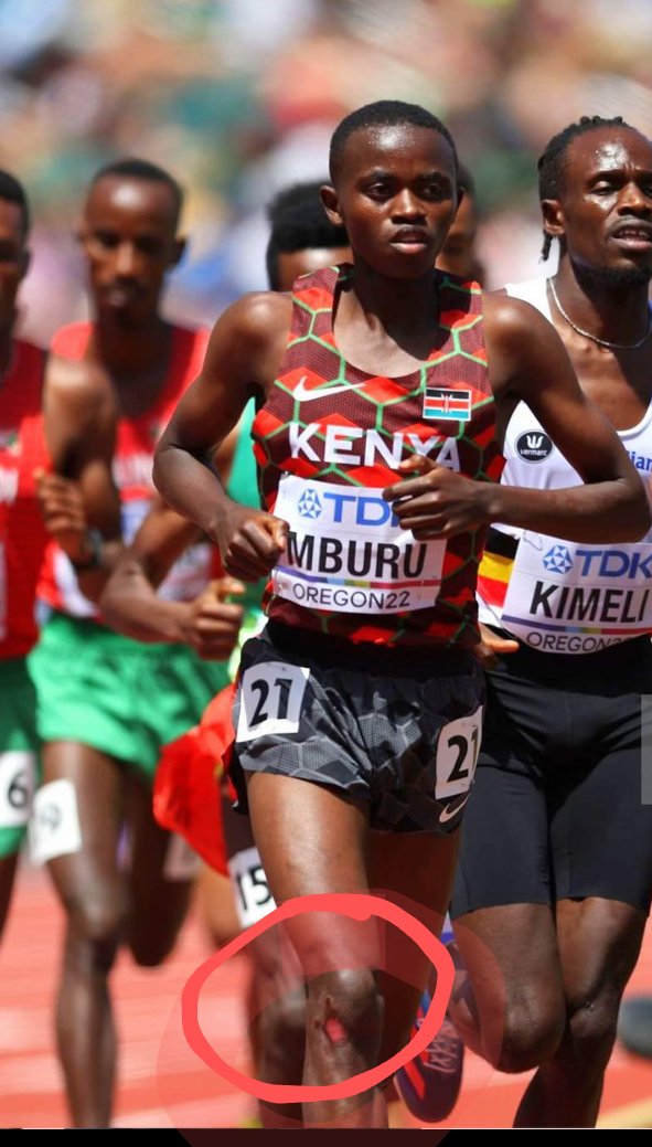Mburu ran with a bruised leg for almost the entire 10,000m, and still bagged a Silver. That's what is called the Kenyan Spirit!
#Oregon2022 

Bahati Wamatangi Usain Bolt Wavinya Ndeti