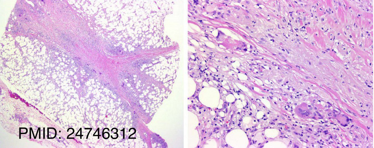 HovAsh3's tweet photo. #dermtwitter #dermatology #MedEd https://t.co/maSwsCk756
