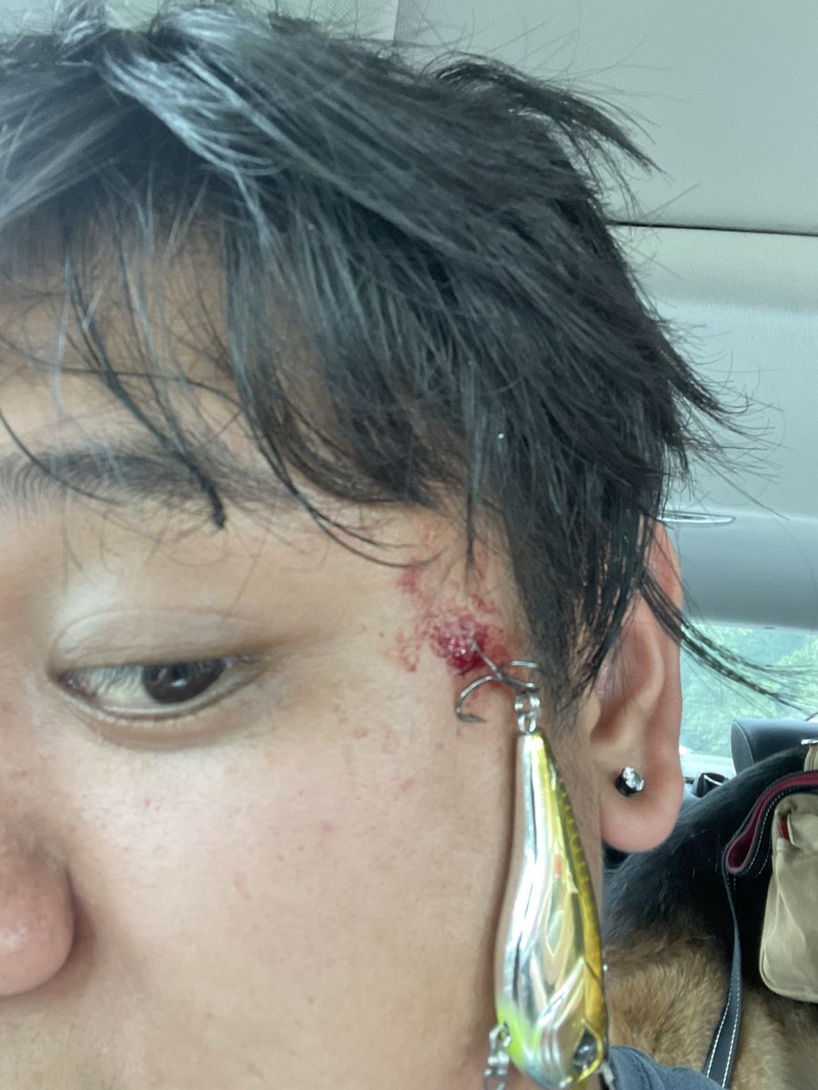 Glizzy_Goob's tweet photo. @googan_squad ended up in ER after hooking my biggest fish… the doctors had to break the hook can I get some new treble hooks since I’m broke from hospital bills https://t.co/wEWZ6x1hAu