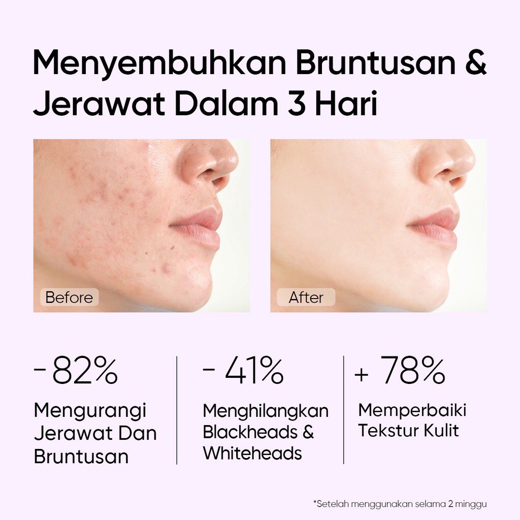 DianLes45332038's tweet photo. Skintific 2pcs set, Toner & Serum
Link : https://t.co/OSWV7rEDDe
💰 Rp. 235.000
Lagi ada voucher diskon juga lho di live nyaa
•
Tag : Hamil, Happy Graduation, MPLS, Sekolah, #SemuaJadiAman, skincare, #ShopeePromo #ShopeeDiskon #Skintific https://t.co/wuO8BWrmNR