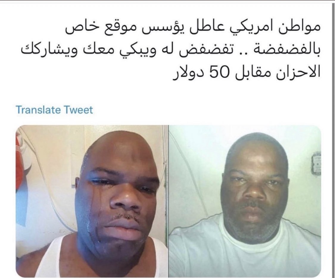 المضيومين تعالو اطبطب عليكم