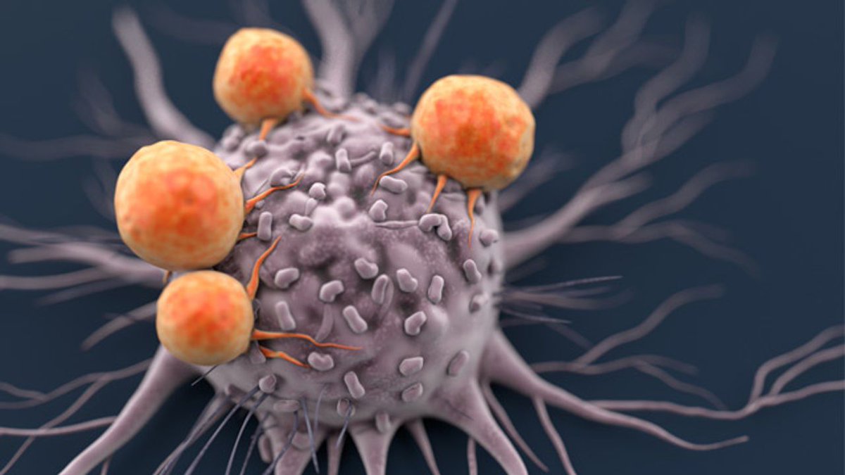 wattjames149's tweet photo. We are grateful to invite you for "7th World Congress on Oncology and Cancer Research" which is going to be held on July 27-28, 2022 | Webinar.
For more details: https://t.co/BzRPHa09ag
#radiologist #cancerbiology #cancertherapy  #palliativecare #nursing #surgery #cancerresearch https://t.co/wDfZ6pvPTa