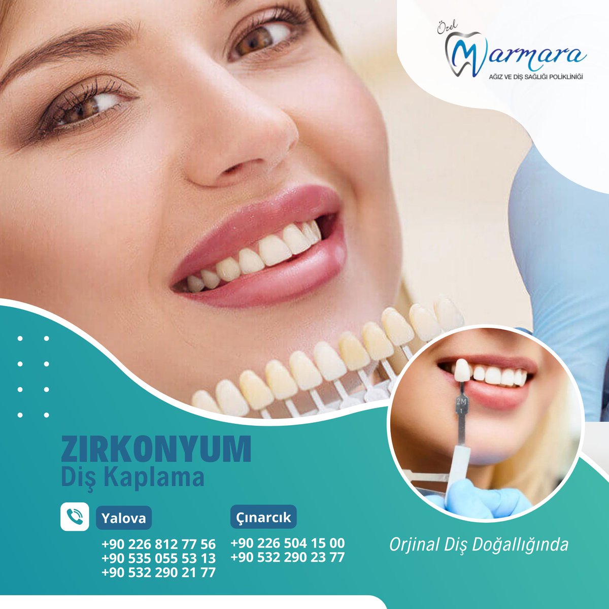 ZİRKONYUM DİŞ KAPLAMA
Orijinal Diş Doğallığında

Zirkonyum yeni nesil, çağdaş bir diş kaplamasıdır. Orijinal bir dişin doğallığına sahip olan zirkonyum diş kaplamaları uzun ömürlü ve estetiktir.

Sağlıklı dişler ve gülüşler dileriz. ozelmarmaradent.com.tr