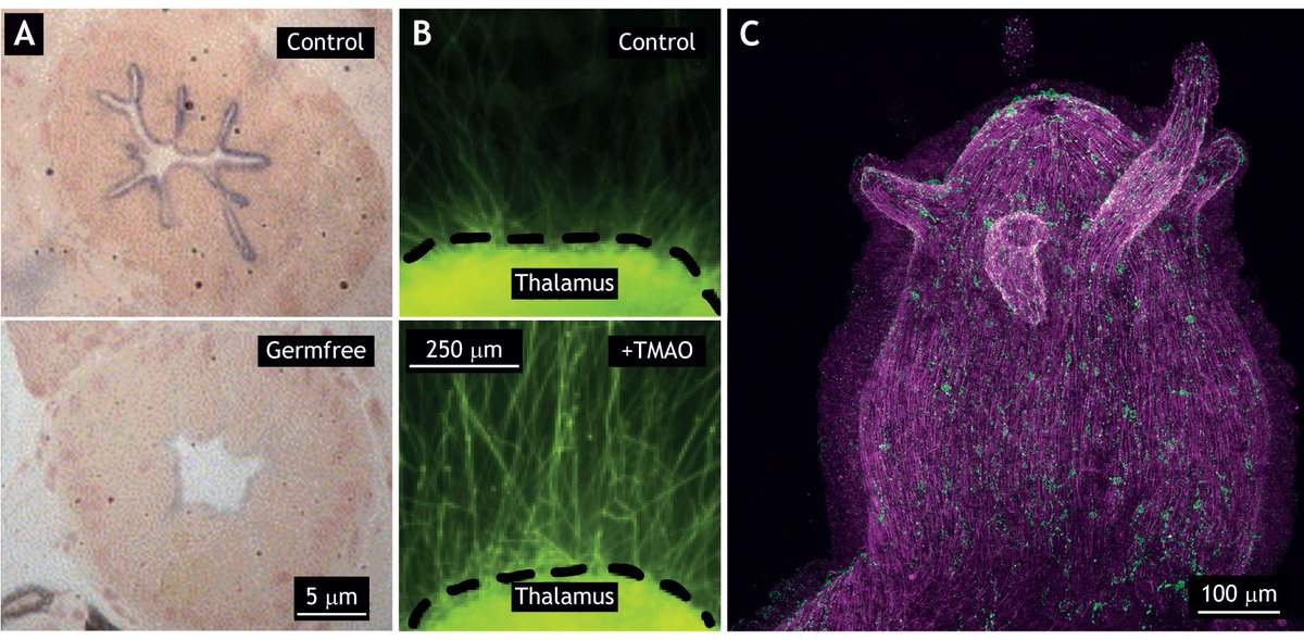 Also in Issue 13:
🔹Research Highlights: preimplantation, chemokines, placenta, heart dev, Auxin &amp; jaw evodevo
🔹In preprint
🔹Author interviews w/ <a href="/Adelaide_Allais/">Adélaïde Allais</a> &amp; <a href="/gregfitzharris/">greg fitzharris</a> 
🔹An Interview w/ <a href="/_Priya_R/">Rashmi Priya @rashmi-priya.bsky.social</a> 
🔹Biodiversity Spotlight
🔹Symbiosis Review
journals.biologists.com/dev/issue/149/…