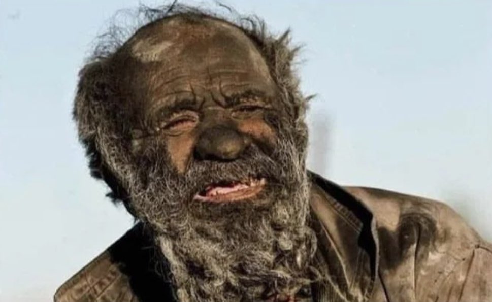 UK people anytime the sun comes out