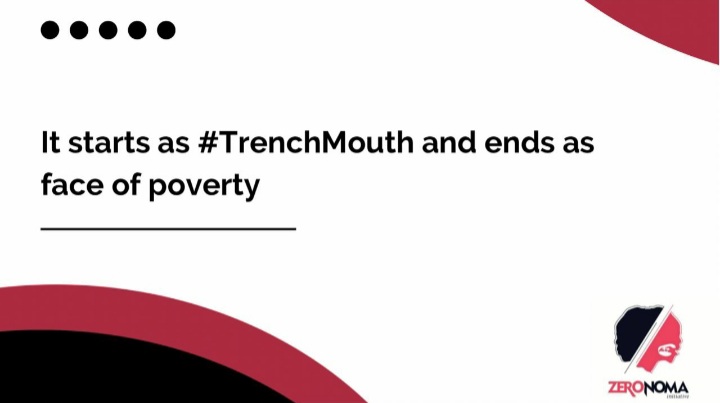 ZeronomaAfrica's tweet photo. A succinct description of #Noma which starts from #ANUG and is largely #preventable
#SDG1 #SDG17
@RSTMH @nighealthwatch @ISNTD_Press @NTDnigeria @Can_NTDs @WHONigeria @NIHRglobal @nads_ng
@ifetula @yangaza209 @NsikakOfAfrica https://t.co/DdzZaJI34w