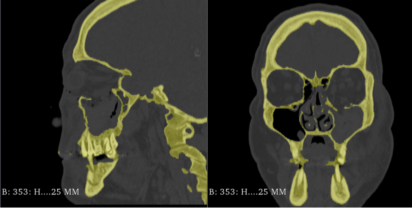 FabLab 3D Hospital Marañón tweet media