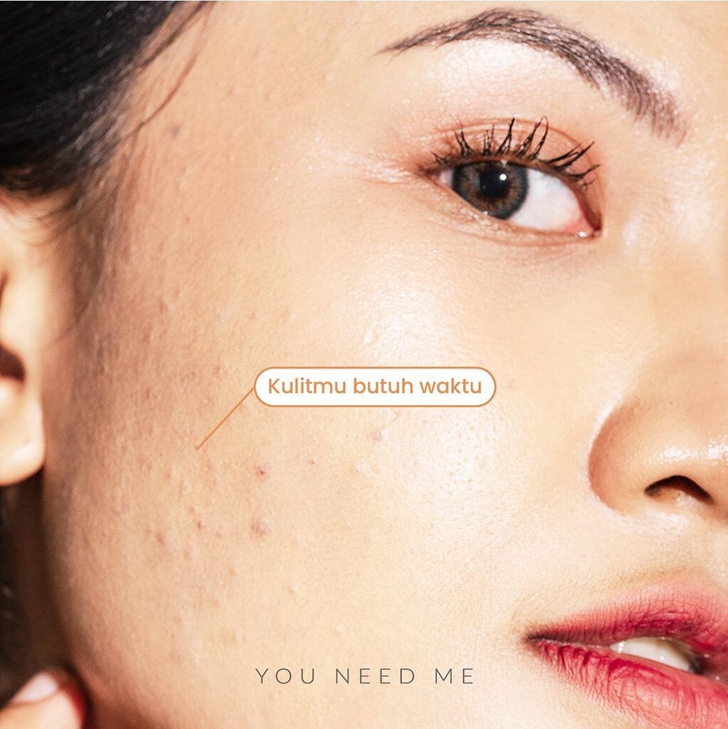 youneedme_id's tweet photo. 🫧TAKE YOUR TIME TO HEAL🫧
Kulitmu butuh proses bestie, dari trial and eror cobain skincare dan inggridients. Akhirnya kamu akan menemukan formula yang tepat untuk kulitmu bestie

✨ karena proses glowing setiap orang berbeda, maka nikmati proses glowing versimu bestie

Ada yan… https://t.co/JKnGrKXqxR