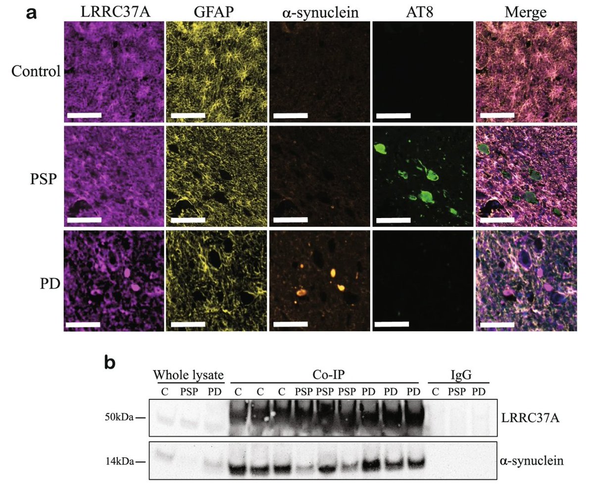 Molecular Neurodegeneration tweet media
