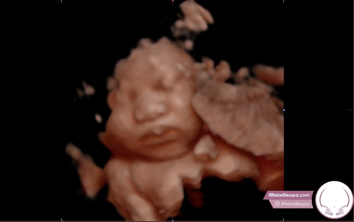 LaTashaGivens1's tweet photo. I can’t believe our 3rd little prince is almost here!!!We already love you soo much baby Wellington Price 👦🏽 Thank you #Alotheradiogod2 for these pics 
For those of you who’ve been asking that I haven’t gotten back to https://t.co/BMGJX2KCZJ #LaTashaGivens #TheGodfreys https://t.co/OqkjWKTZQD