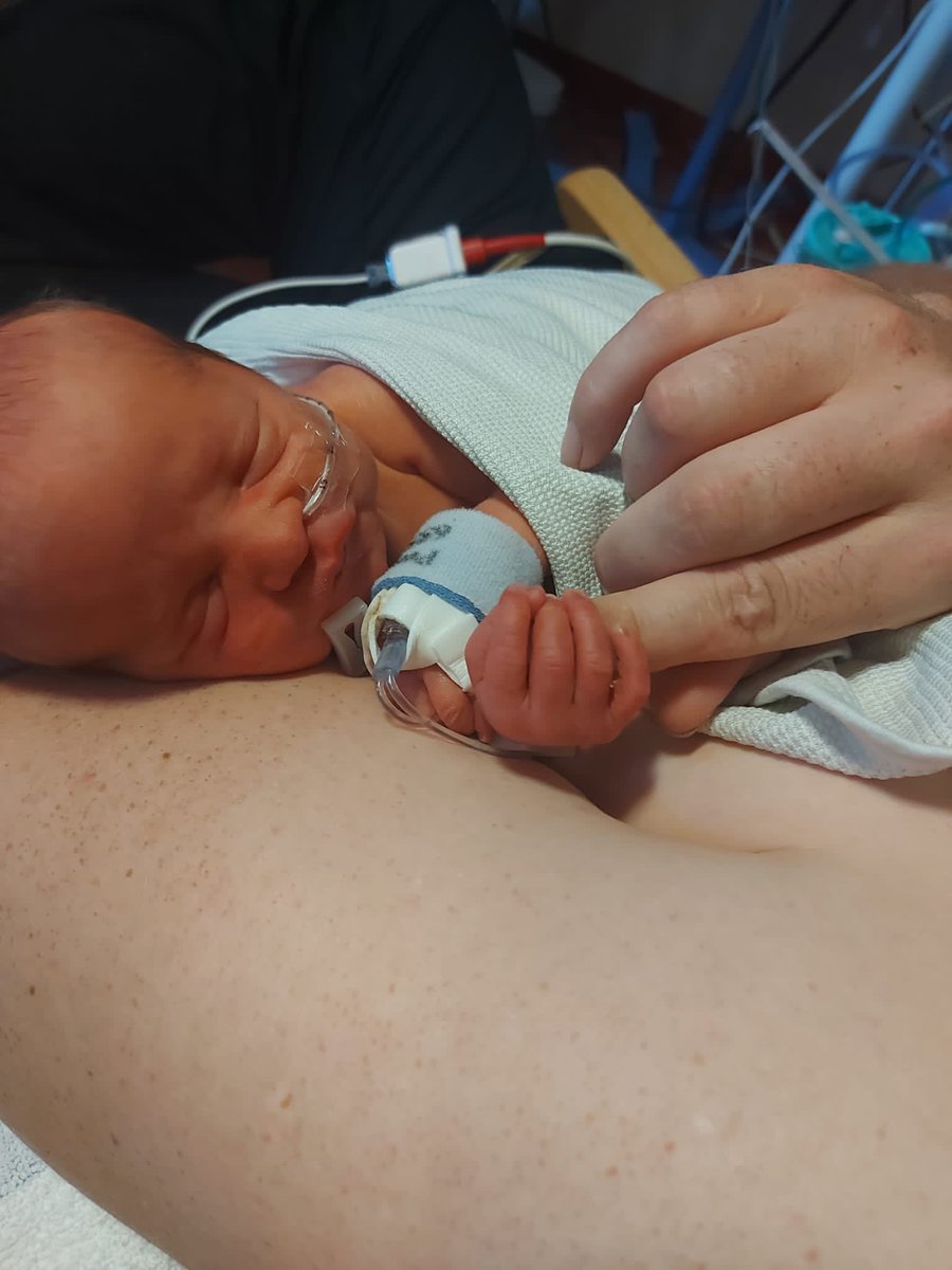 CALLIFRAY's tweet photo. My little grandson arrived 9 weeks early on Saturday 16/7๐คฆ๐ปโโ๏ธheโs doing well and off his ventilator and heโs moving out of intensive care later ๐ what a lovely suprise #BillyAlexander ๐ https://t.co/Qn4GVH6fpX