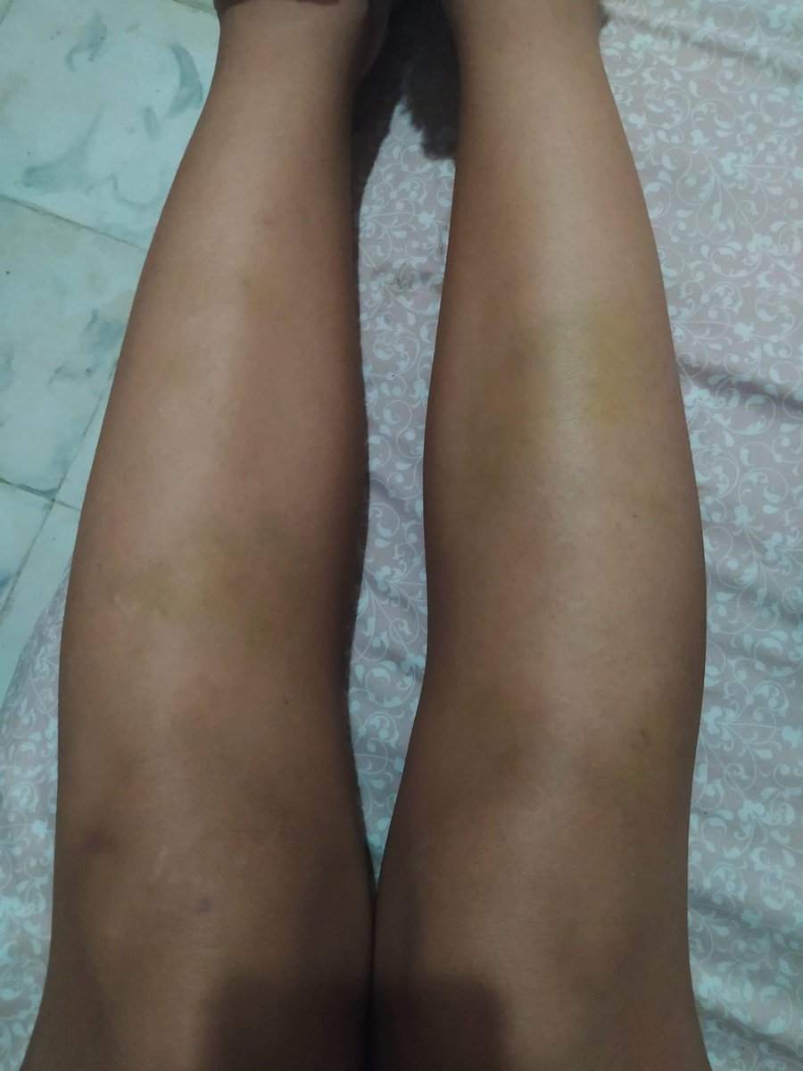 QueQuintana's tweet photo. Joven Redacta que su ex pareja que trabaja con la Presidenta Municipal #Yensuni, dentro de la relación con Oscar Emmanuel Martínez Carrillo, fue víctima de diferentes tipos de violencia de su parte. 

Nota: https://t.co/0lVl2FLAZH

#Violencia #QuintanaRoo #Gobierno #Chetumal https://t.co/O2IF8ndIDF