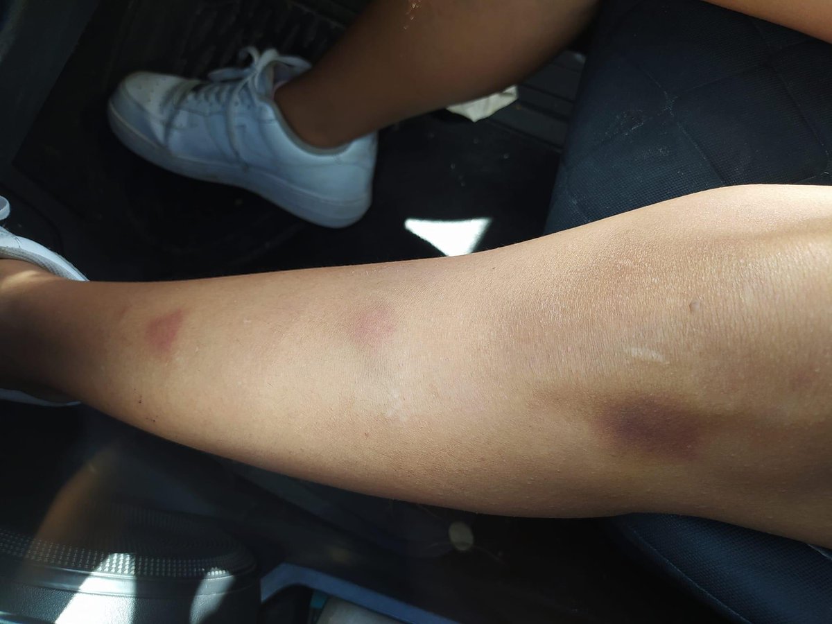 QueQuintana's tweet photo. Joven Redacta que su ex pareja que trabaja con la Presidenta Municipal #Yensuni, dentro de la relación con Oscar Emmanuel Martínez Carrillo, fue víctima de diferentes tipos de violencia de su parte. 

Nota: https://t.co/0lVl2FLAZH

#Violencia #QuintanaRoo #Gobierno #Chetumal https://t.co/O2IF8ndIDF