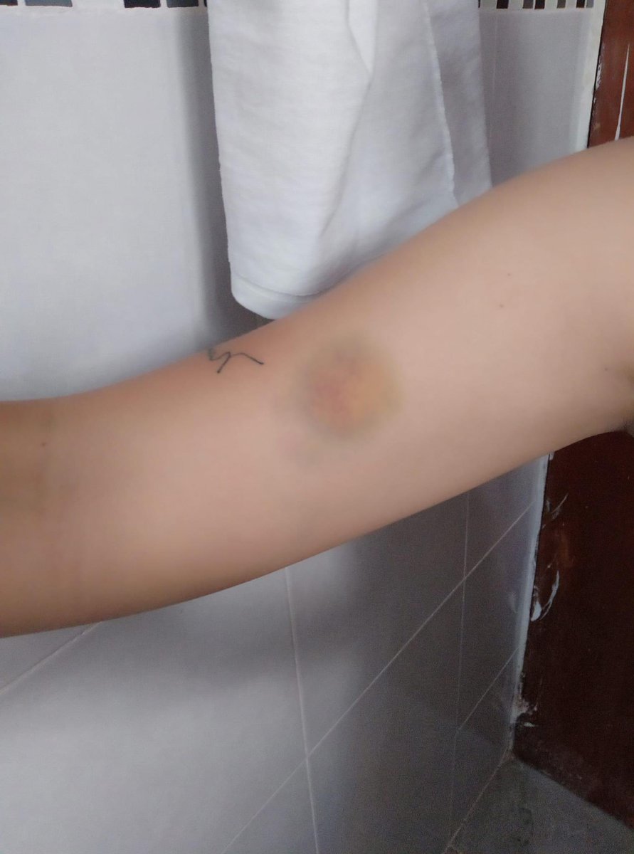 QueQuintana's tweet photo. Joven Redacta que su ex pareja que trabaja con la Presidenta Municipal #Yensuni, dentro de la relación con Oscar Emmanuel Martínez Carrillo, fue víctima de diferentes tipos de violencia de su parte. 

Nota: https://t.co/0lVl2FLAZH

#Violencia #QuintanaRoo #Gobierno #Chetumal https://t.co/O2IF8ndIDF
