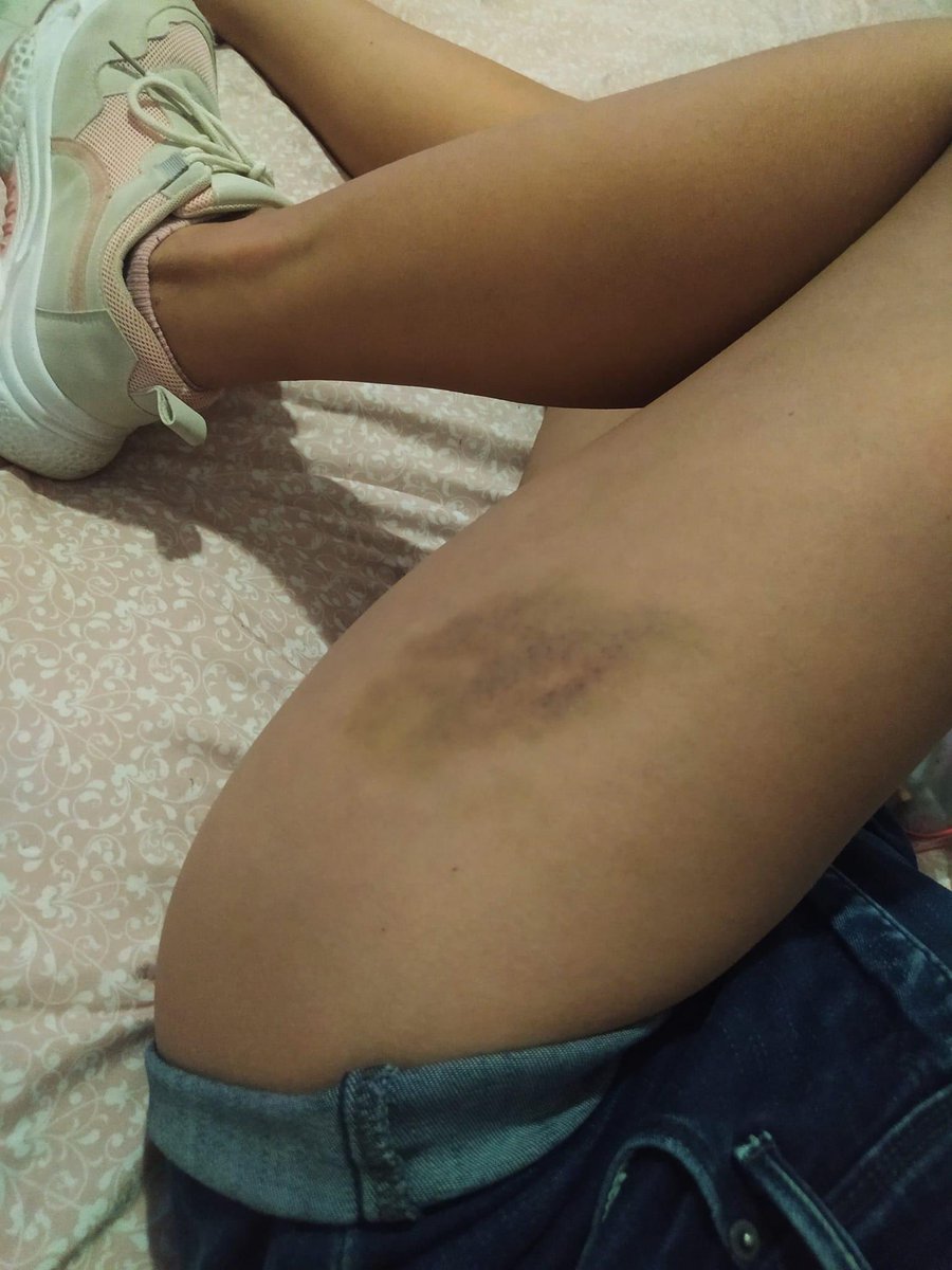 QueQuintana's tweet photo. Joven Redacta que su ex pareja que trabaja con la Presidenta Municipal #Yensuni, dentro de la relación con Oscar Emmanuel Martínez Carrillo, fue víctima de diferentes tipos de violencia de su parte. 

Nota: https://t.co/0lVl2FLAZH

#Violencia #QuintanaRoo #Gobierno #Chetumal https://t.co/O2IF8ndIDF
