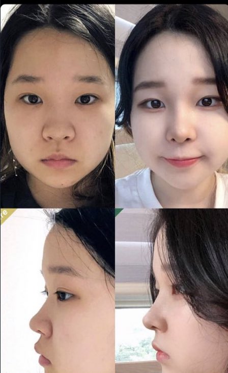 この変化すごく好みだけど日本人のレビューがなかなか見つからない😭