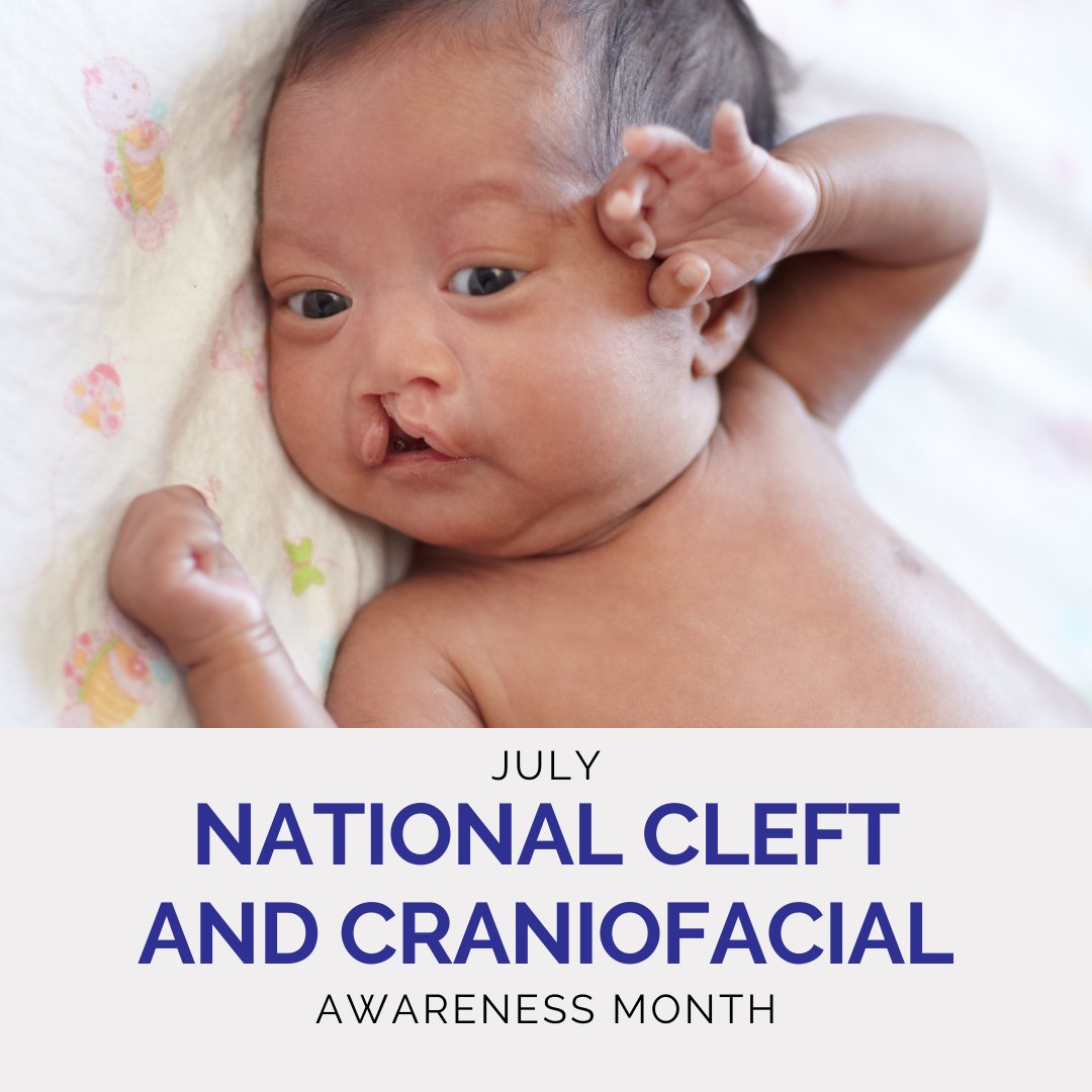 Each year in the United States, approximately 2,600 babies are born with a cleft palate.
​
​July is National Cleft and Craniofacial Awareness Month, a time to raise awareness and improve understanding of craniofacial anomalies.
​
​If you have any questions, talk to us.