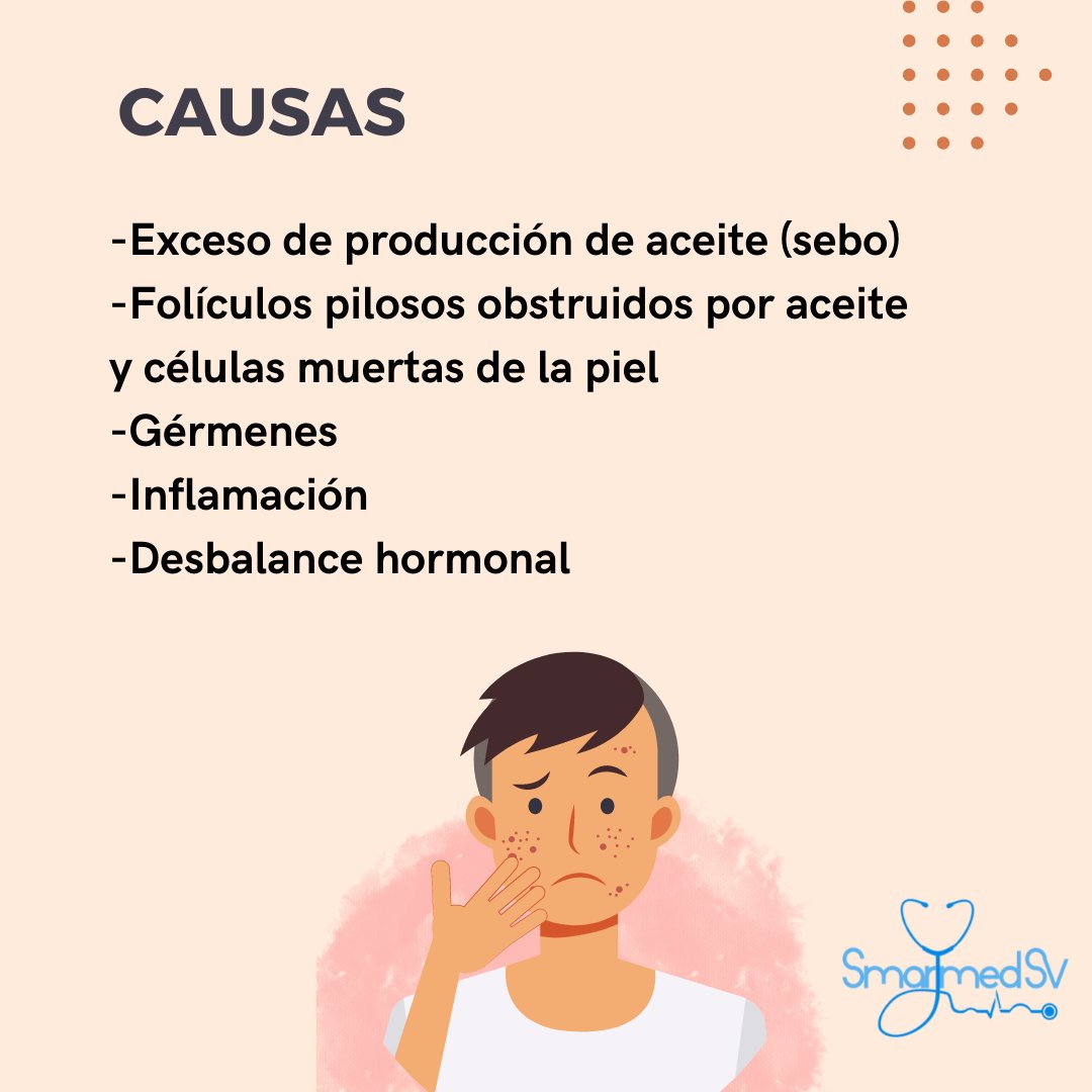 SmartMed_sv's tweet photo. Hablemos sobre 🔹Acne🔹
Escrito por Dra. Kathya Jimenez. 
@KathyaJimenezMD  
#SmartMed_sv  
#smarttalksv https://t.co/SHpa25Zz2s