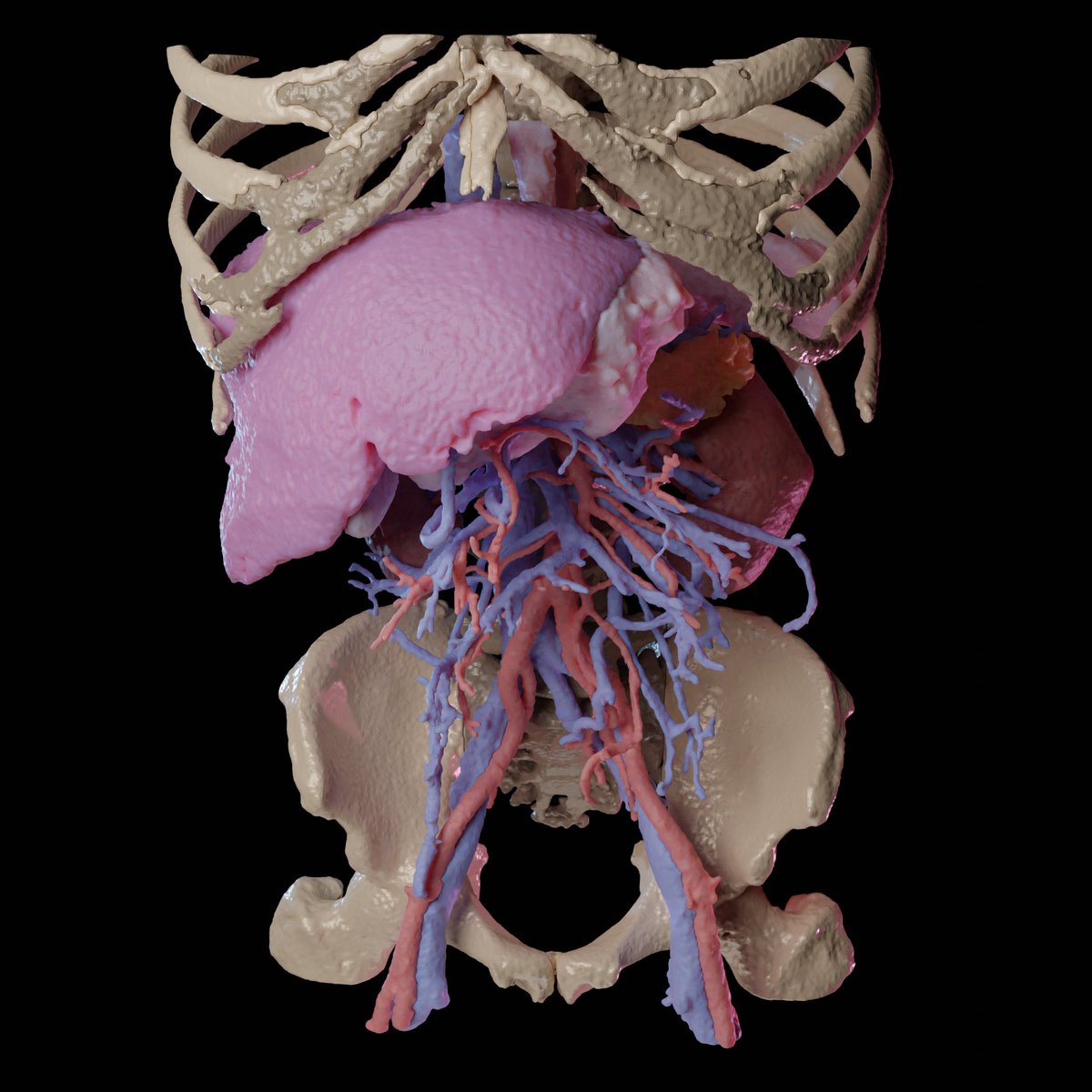 FedeEspinolaS's tweet photo. I believe that advanced 3D imaging has a bright future in surgery, from preoperative planning to education #ucl @UCLDivofSurgery @uclmedsci @itksnap @BlenderStudio_ https://t.co/OBXxsH7oVZ