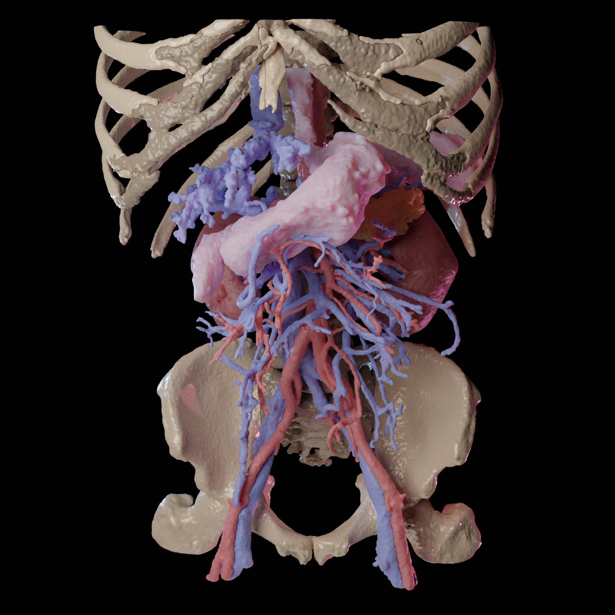 FedeEspinolaS's tweet photo. I believe that advanced 3D imaging has a bright future in surgery, from preoperative planning to education #ucl @UCLDivofSurgery @uclmedsci @itksnap @BlenderStudio_ https://t.co/OBXxsH7oVZ