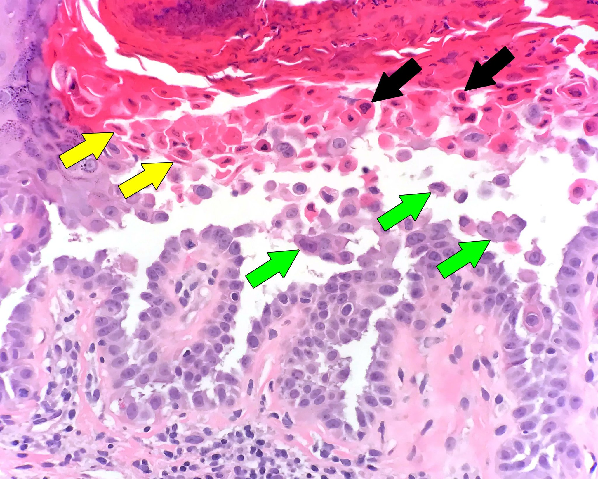 Jerad Gardner, MD on Twitter: