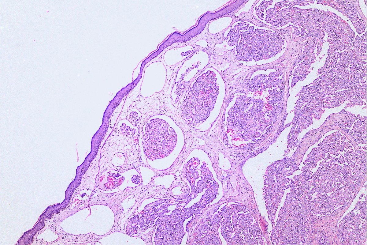 padmapathology1 tweet picture