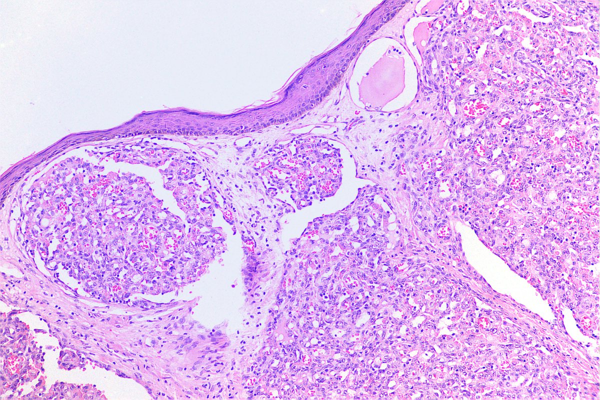 padmapathology1 tweet picture