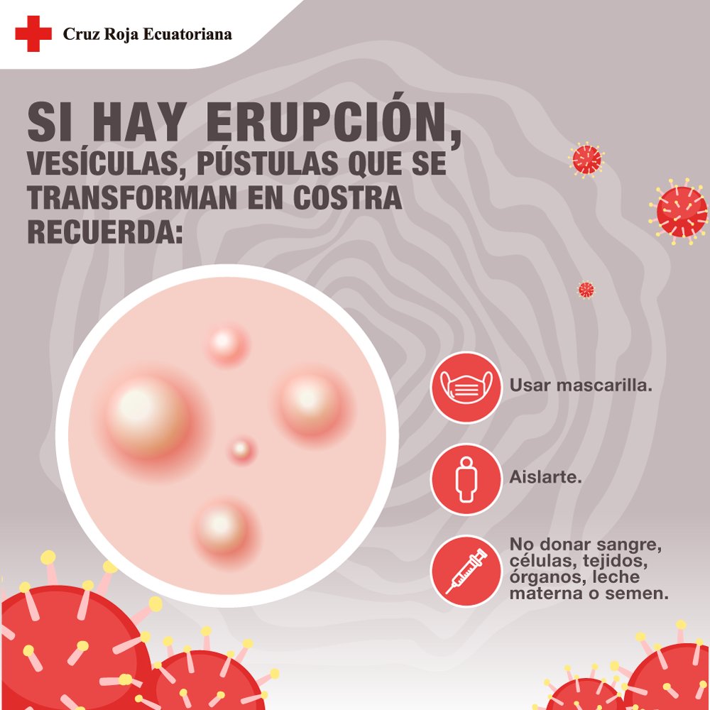 #TeQueremosSano 🤗❤️

¡Estar protegidos es responsabilidad de todos y todas! 
🧐Presta atención a estas recomendaciones. 

#ReafirmamosNuestroCompromisoPorLaVida