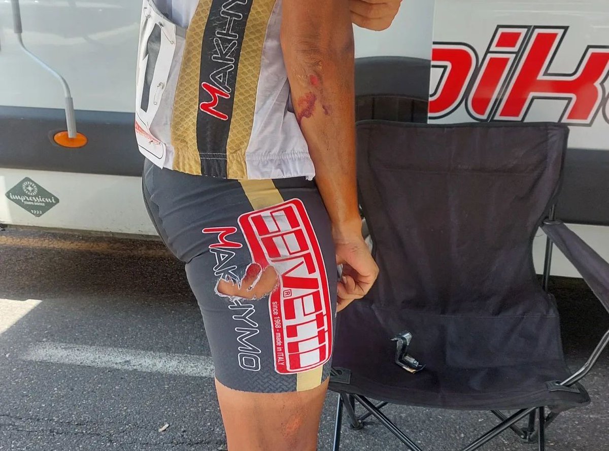 lajornadacrc's tweet photo. Solo dos ciclistas del Team Servetto siguen compitiendo en el Giro de Italia 2022 (carrera por etapas más exigente del mundo) y una de ellas es la costarricense Milagro Mena. Pese a sufrir varias caídas, la ciclista nacional continúa luchando. 🚴🏻‍♀️

¡Está haciendo historia! 🇨🇷 https://t.co/wWkaZE8s6v