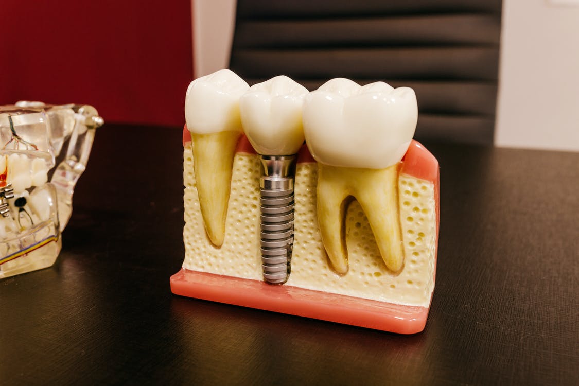 HermitHelmet's tweet photo. Your smile is one of the first things people notice about you. If you're not happy with your smile, it can affect your self-confidence. Crooked or misaligned teeth can also lead to more serious dental problems down the road. Click here: https://t.co/lwyCDr9prY https://t.co/6qRf7oZnwG