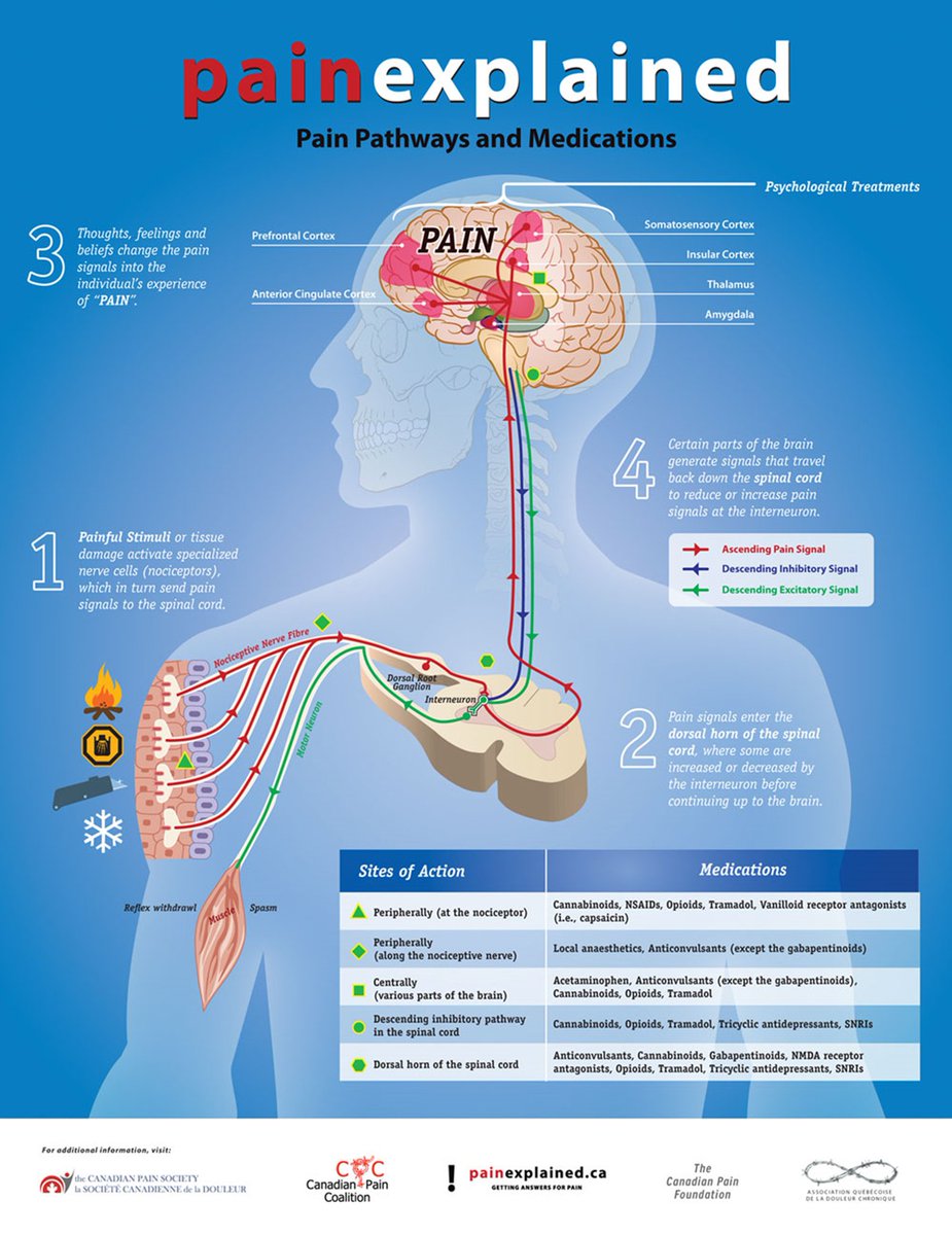 PalingClaire's tweet photo. Love this infographic about pain!

Is this ok for use in patient and clinician teaching resources @CanadianPain? https://t.co/cBlN0KbqrD