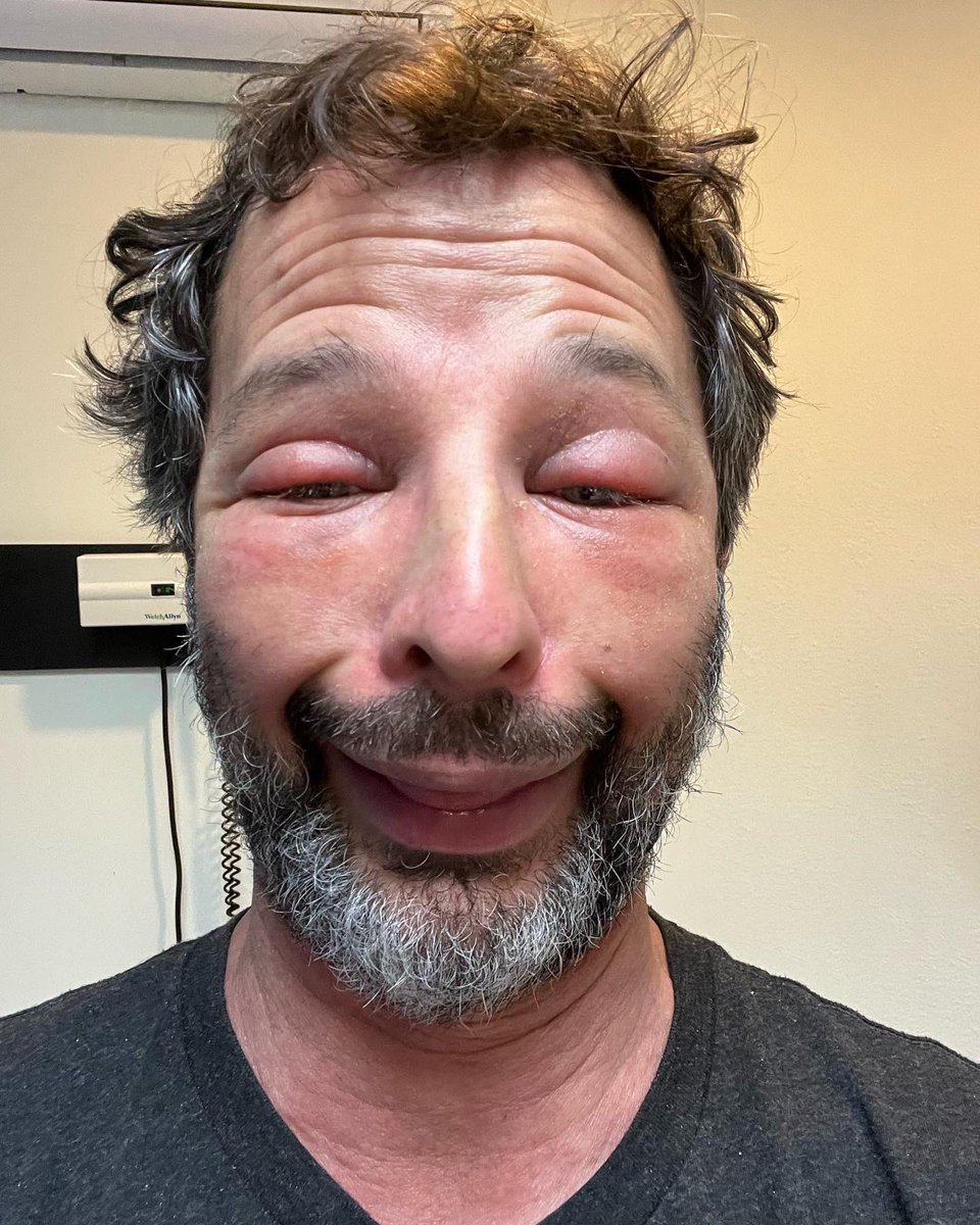 nick kroll tweet media