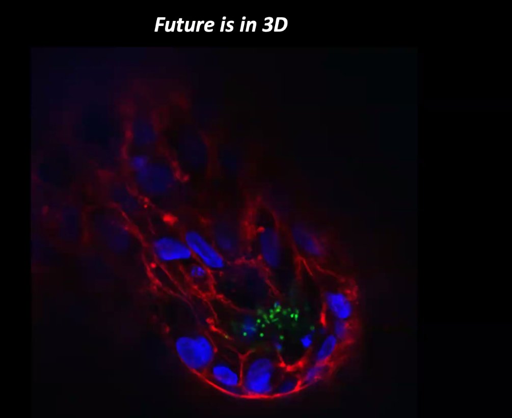 3dbionet (@3dbionet) on Twitter photo Fascinating Keynote lecture by Dr Francesco Boccellato <a href="/Boc_Lab/">Boccellato_Lab</a> at #Oxford today #3Dbio #workshop Fascinating Keynote lecture by Dr Francesco Boccellato <a href="/Boc_Lab/">Boccellato_Lab</a> at #Oxford today #3Dbio #workshop