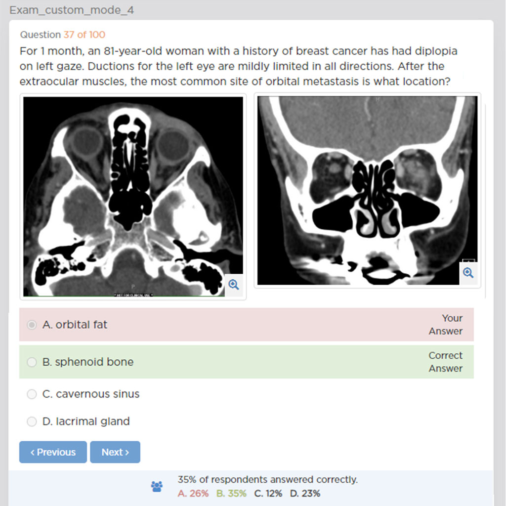 Bcsc Question AAO on Twitter: