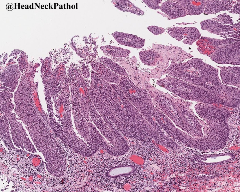 Lester Thompson tweet media